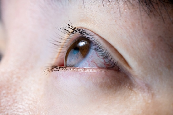 目の充血・目が赤い原因について