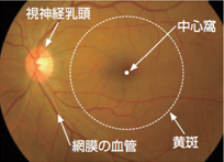 正常な目の眼底写真