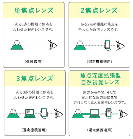 他の眼内レンズとの比較