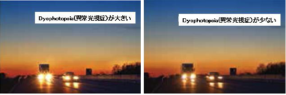 図 5 Dysphotopsia （異常光視症）