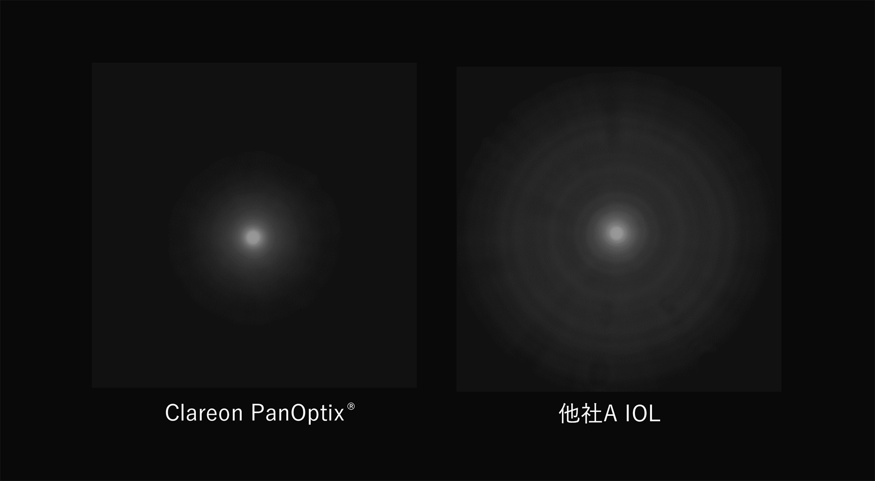 Clareon®PanOptix®は他社A IOLと比較し、グレアハローを低減させることが示されております